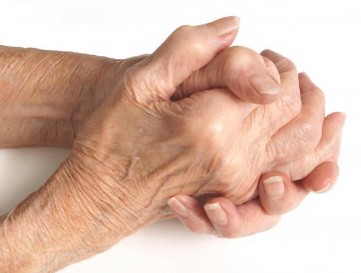 Advanced arthritis in the hands may make it hard to pick up objects.