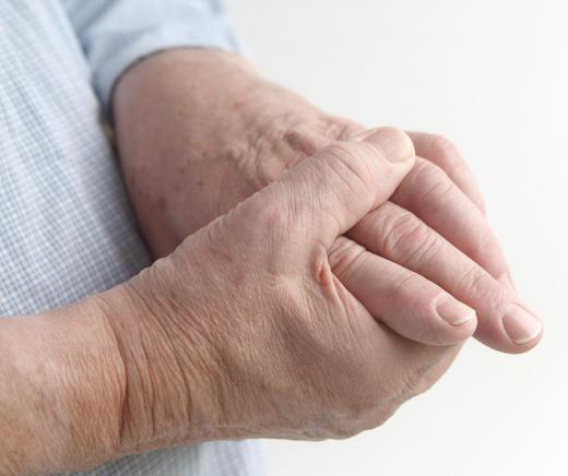 Arthritis may cause hand inflammation.