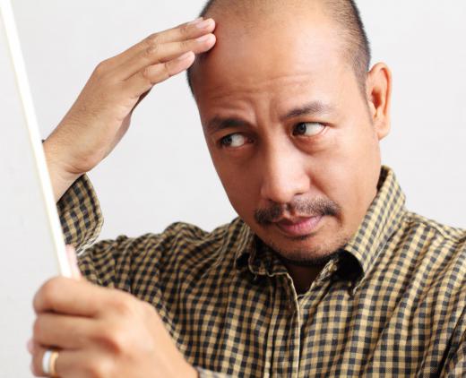 Hair loss is a common symptom of pili annulati.