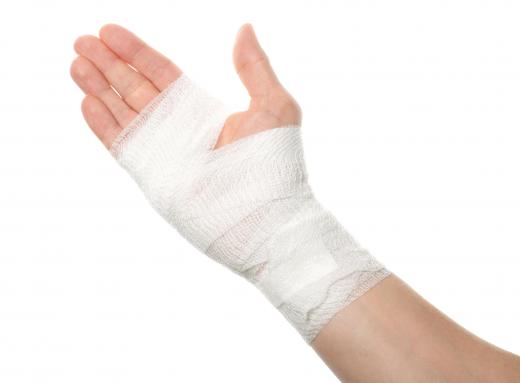 Sterile gauze is applied and wrapped to an open burn or laceration to prevent infection.