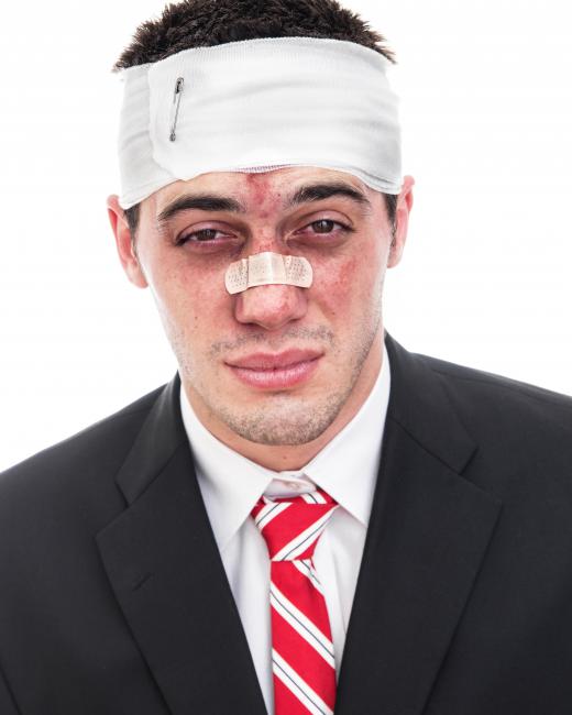 Medial wall fractures may occur when there has been facial trauma.