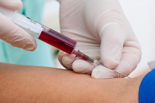 Metabolic profiling is a series of blood tests that help physicians diagnose medical problems.