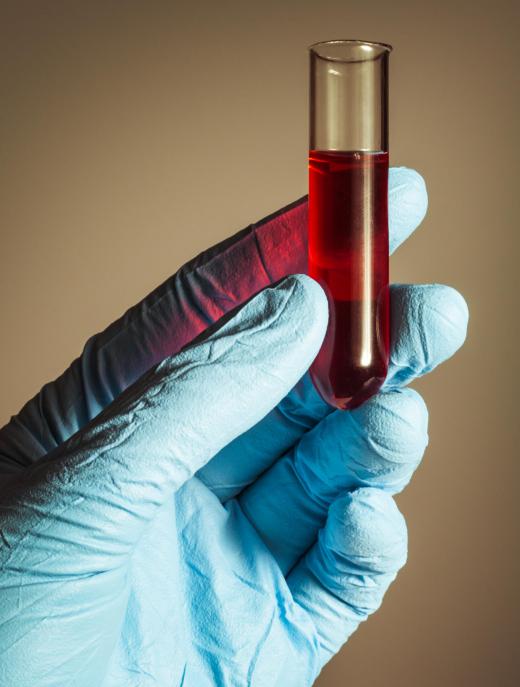 Blood amylase tests check for inflammation of the pancreas.