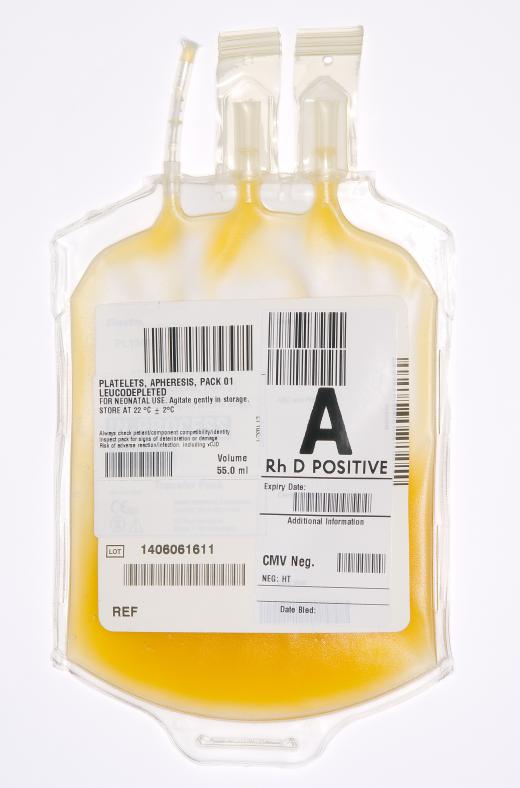 A bag of blood plasma, which contains plasma proteins.