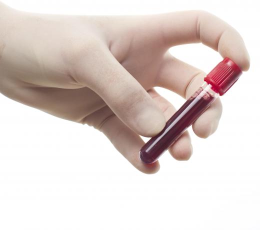 Blood testing may determine the cause of clotting mechanism issues.