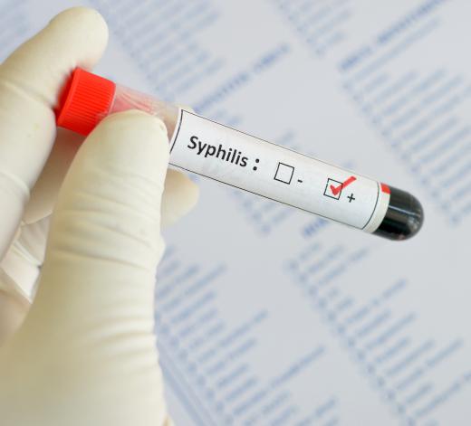 Syphilis is a commons STD which can lead to the damage of major internal organs.