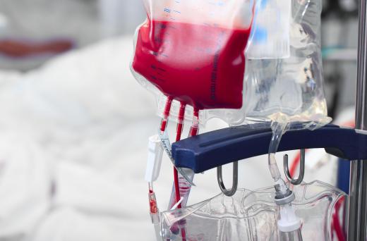 Blood transfusions may be part of the treatment for septicemia.