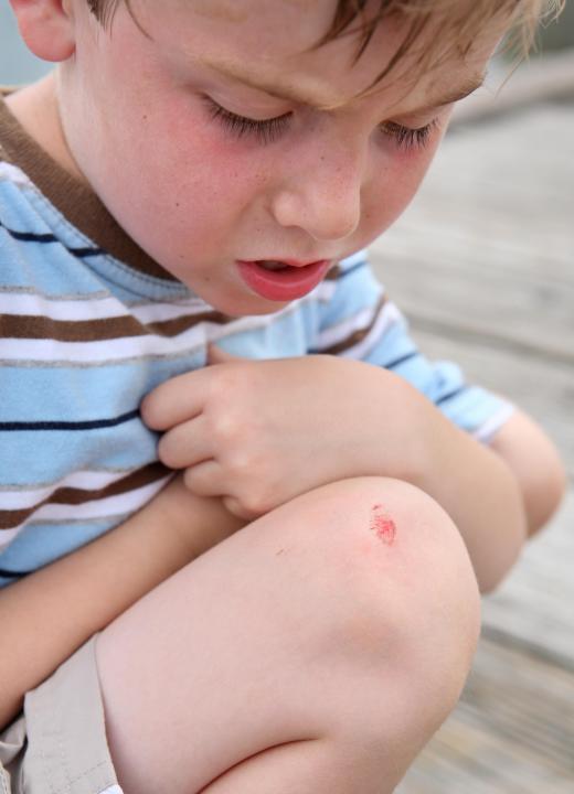 Scrapes, also known as abrasions, are caused when shallow layers of skin are scraped off by contact with a surface.