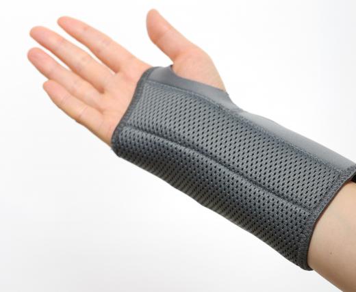 The healing time for wrist drop depends on whether or not the radial nerve is damaged.