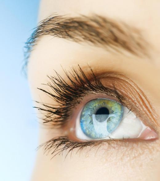 Iridocyclitis is an inflammation of the iris and the ciliary body of the eye.