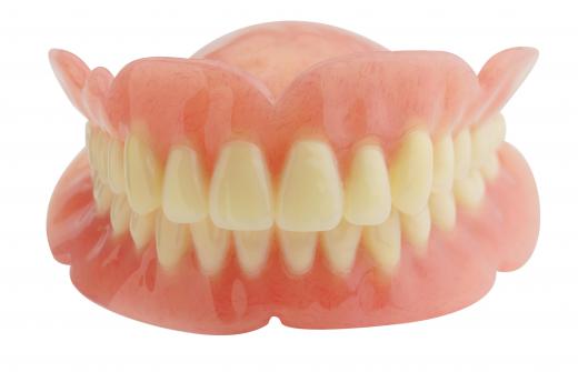 Denture wearers are at high risk for developing an oral yeast infection, which may cause white tongue.