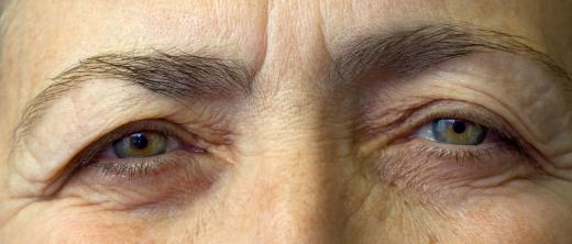 Dry eyes, which are a byproduct of aging, may cause twitching under the eye.