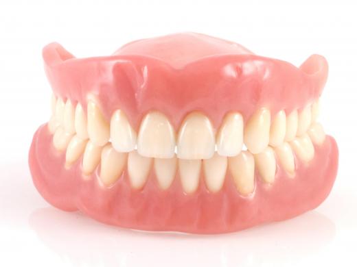 Traditional dentures.