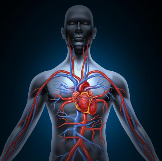 A coronary artery spasm is a momentary constriction of an artery, which can be silent or painful.