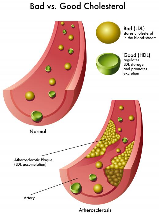 ALA can help treat high cholesterol levels.