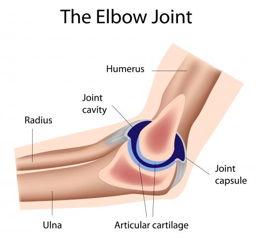 The elbow joint. Intra-articular is the space inside the joint, usually contained by the joint capsule.