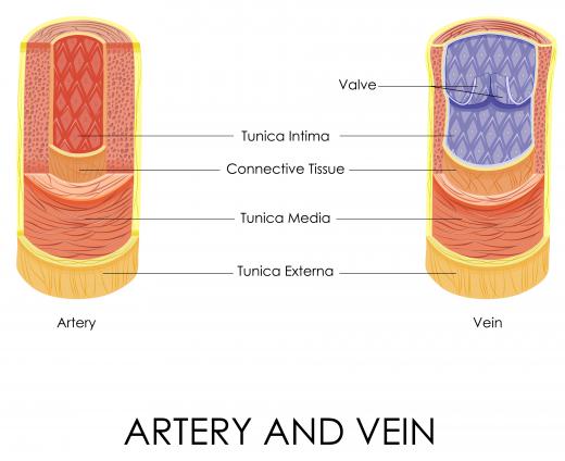 A hepatic vein carries oxygen depleted blood out of the liver.