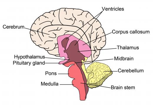 A tumor can develop on the hypothalamus gland due to cancer or mutated brain cells.