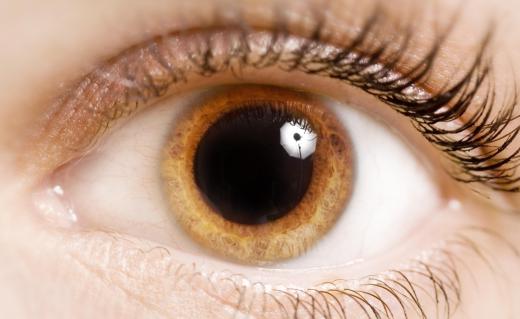 A person with a dilated pupil.