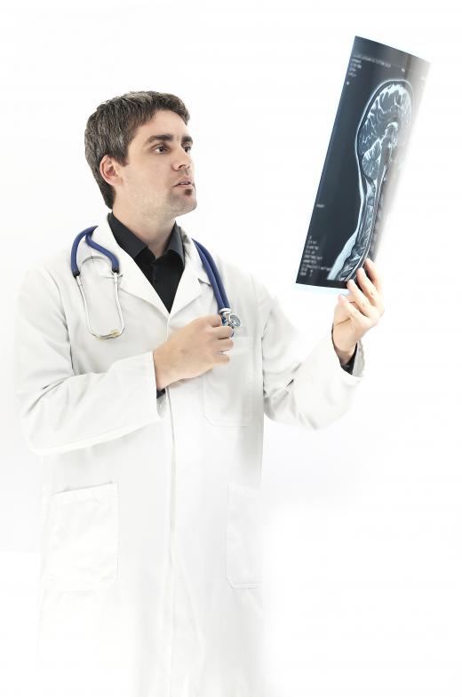 A doctor looking at a head X-ray to check for a fracture.