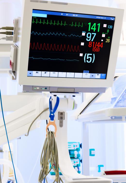 An increased heart rate is one sign a patient under anesthesia may be rousing.