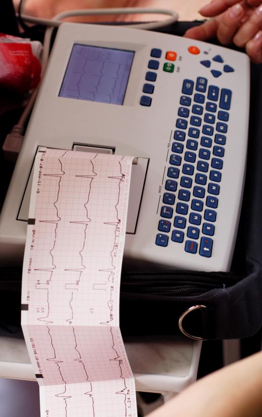 Electrocardiograph machine and readout.