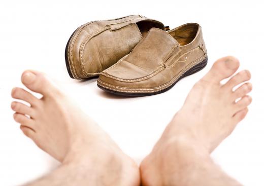 Ill-fitting shoes may cause the development of a ganglion foot cyst.