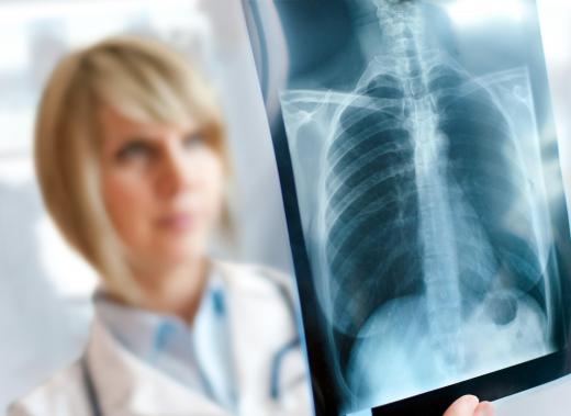 Bronchial inflammation can be detected via chest X-ray.