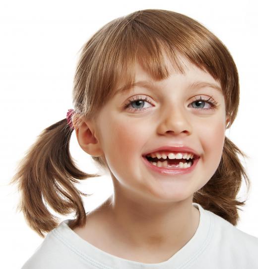 Children with lisps or other speech disorders might need speech therapy.