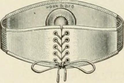 A hernia belt is an example of a hernia truss.