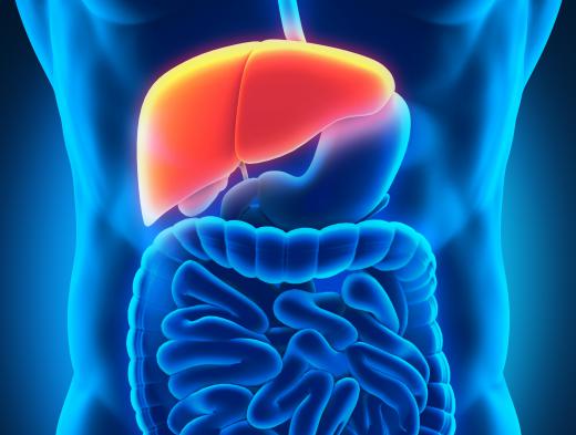 Focal nodular hyperplasia is a type of benign tumor in the liver.