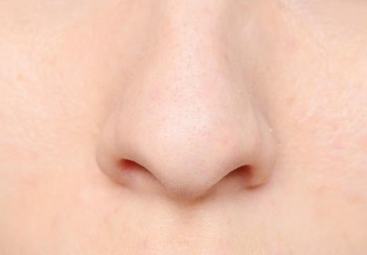 Allergies may cause nose inflammation.