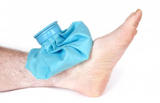 Ice packs can be applied to feet to help bring the swelling down.