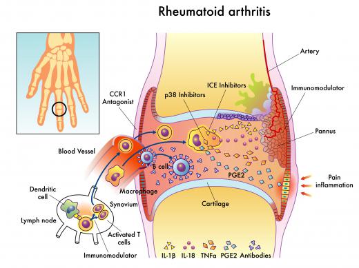 People with rheumatoid arthritis have antibodies in their blood that prevent filaggrin from functioning.