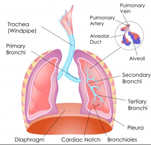 Pneumothorax occurs when air fills the pleural cavity.