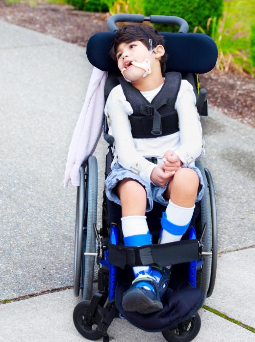 Many people with spastic diplegic cerebral palsy can use a wheelchair.