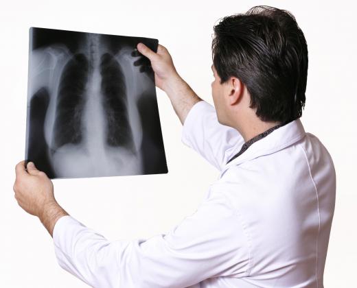 Clindamycin may be used to treat severe lung infections.