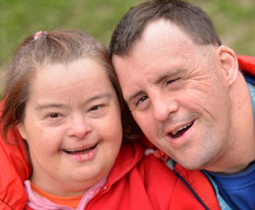 Children with Down Syndrome typically have a distinct physical appearance.