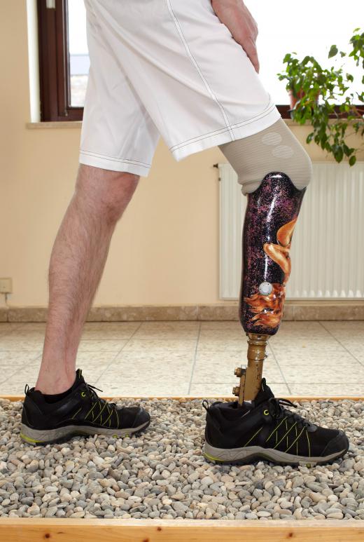 A prosthetic limb must be created special for the person using it.