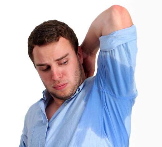 People prone to sweaty palms may experience excessive sweating in other parts of the body.