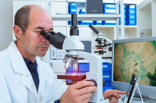 After removal, a pathologist may look at the angioma under a microscope to ensure it is benign.