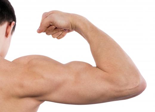 Weight training commonly causes a torn bicep.