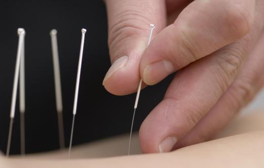 Acupuncture may be helpful for someone suffering from a protruding disc.