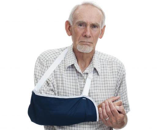 A sling may be required to treat a proximal humerus fracture.