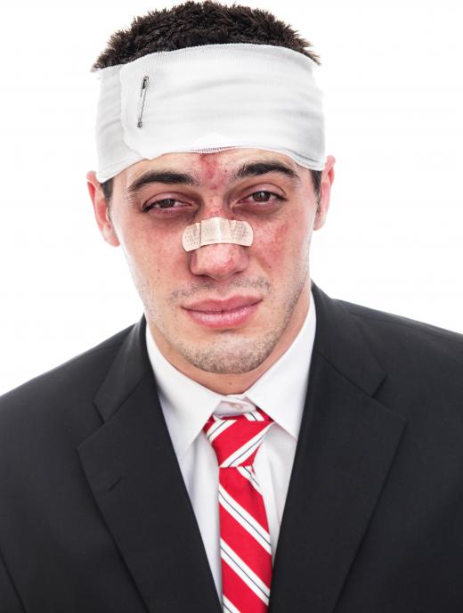 Broken noses are a common type of facial injury.