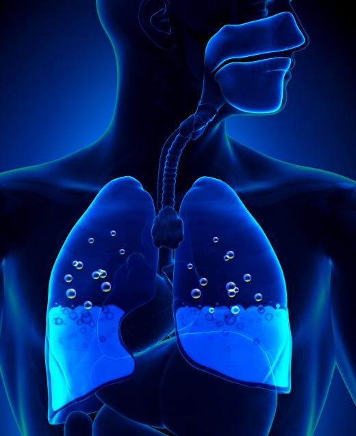 The pleural cavity in the lungs normally only has a few milliliters of fluid, but has the potential to collect hundreds or thousands of milliliters of fluid in pathologic situations.