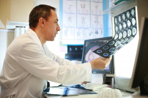 A medical professional reviewing an MRI.