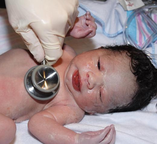 Repairs for congenital defects may require a sternotomy.