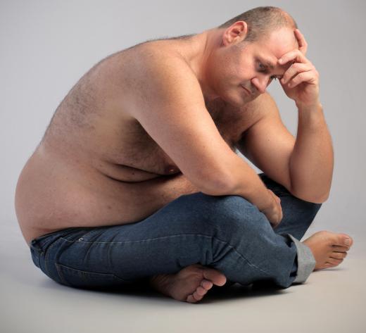 Obesity is considered a primary host factor for many conditions.