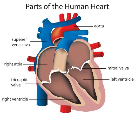 In hypoplastic right heart syndrome, the right side of the heart, including the ventricle, tricuspid valve and atrium do not develop properly.